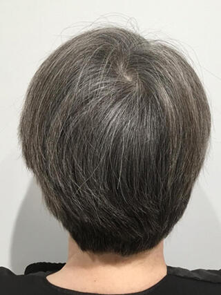 Photo avant : vue arrière d'une femme aux cheveux noirs courts avec beaucoup de cheveux blancs avant la couleur.